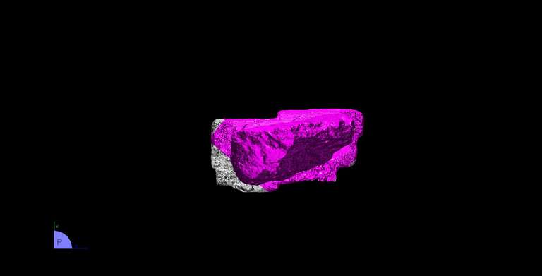 Selektierte Vermaschung